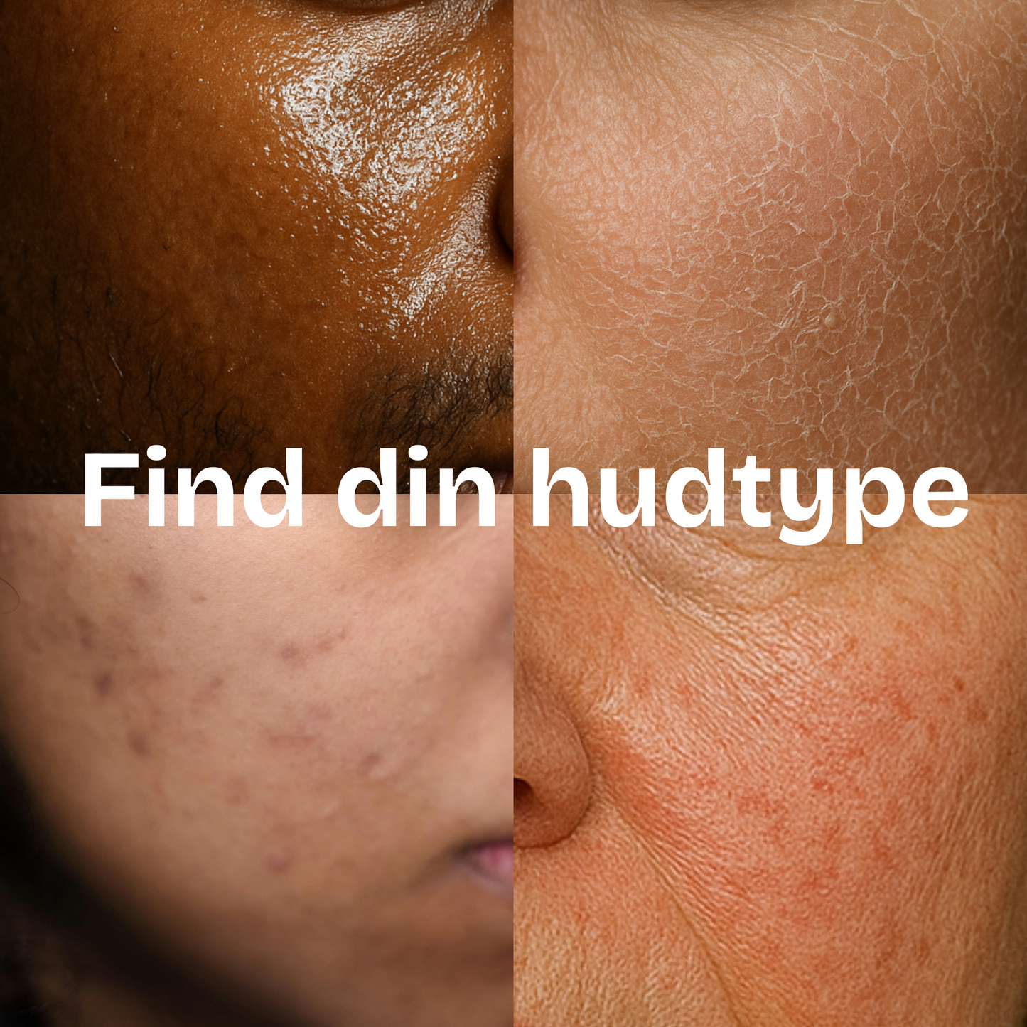 Guide: Find din hudtype