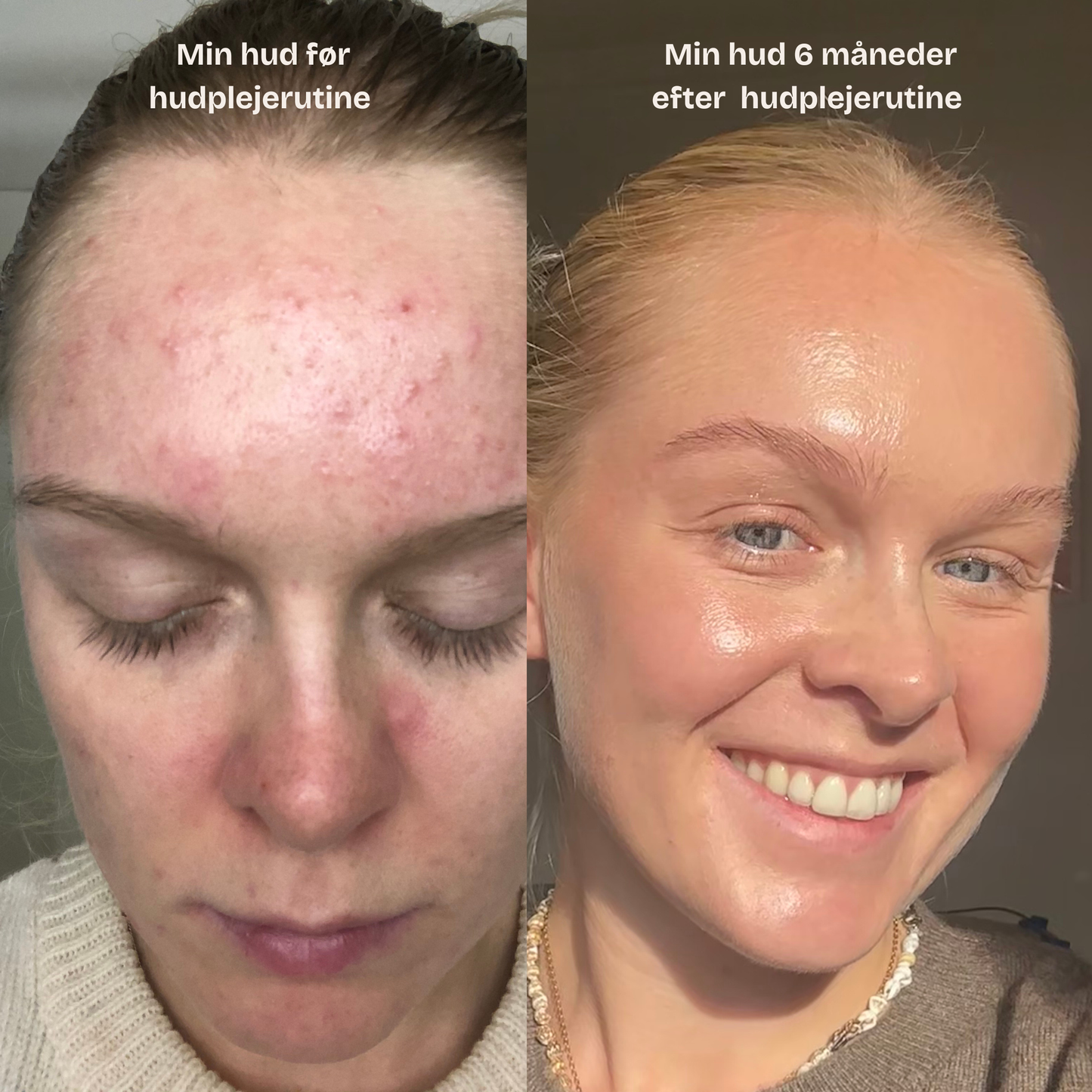 Skræddersyet hudplejerutine